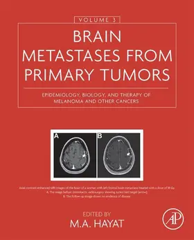 Hayat | Brain Metastases from Primary Tumors, Volume 3 | E-Book | sack.de