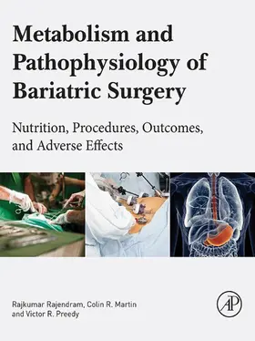 Rajendram AKC / Rajendram / Martin BSc |  Metabolism and Pathophysiology of Bariatric Surgery | eBook | Sack Fachmedien