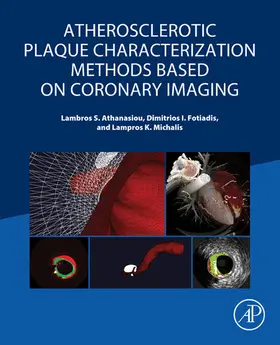 Athanasiou / Fotiadis / Michalis |  Atherosclerotic Plaque Characterization Methods Based on Coronary Imaging | eBook | Sack Fachmedien