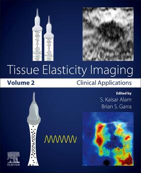 Alam / Garra | Tissue Elasticity Imaging | Buch | 978-0-12-809662-8 | sack.de