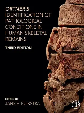 Buikstra | Ortner's Identification of Pathological Conditions in Human Skeletal Remains | E-Book | www.sack.de