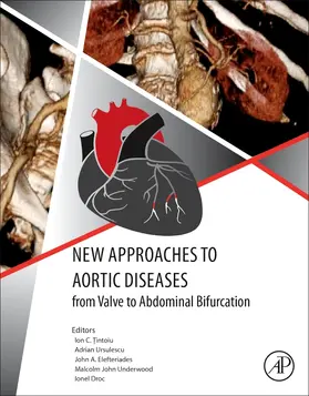 Tintoiu / Elefteriades / Ursulescu |  New Approaches to Aortic Diseases from Valve to Abdominal Bifurcation | Buch |  Sack Fachmedien