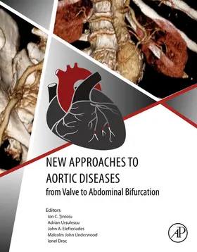 Tintoiu / Elefteriades MD / Ursulescu |  New Approaches to Aortic Diseases from Valve to Abdominal Bifurcation | eBook | Sack Fachmedien
