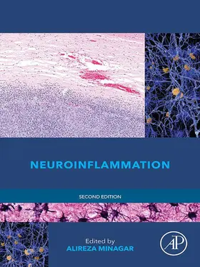 Minagar MD / Minagar |  Neuroinflammation | eBook | Sack Fachmedien