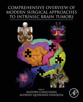 Chaichana MD / Chaichana / Quinones-Hinojosa MD | Comprehensive Overview of Modern Surgical Approaches to Intrinsic Brain Tumors | E-Book | sack.de