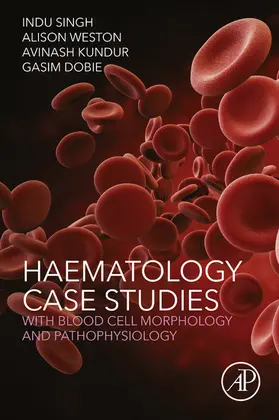 Singh / Weston / Kundur |  Haematology Case Studies with Blood Cell Morphology and Pathophysiology | eBook | Sack Fachmedien