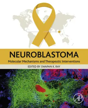 Ray |  Neuroblastoma | eBook | Sack Fachmedien