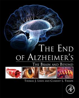 Lewis / Trempe | The End of Alzheimer's | Buch | 978-0-12-812112-2 | sack.de