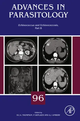 Thompson / Deplazes |  Echinococcus and Echinococcosis, Part B | eBook | Sack Fachmedien