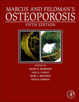 Dempster / Cauley / Bouxsein | MARCUS & FELDMANS OSTEOPOROSIS | Buch | 978-0-12-813073-5 | sack.de