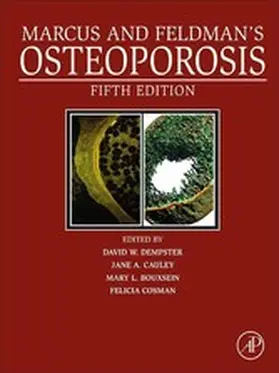 Dempster / Cauley / Bouxsein | Marcus and Feldman's Osteoporosis | E-Book | sack.de