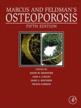 Cosman | Marcus and Feldman's Osteoporosis | E-Book | sack.de