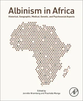 Kromberg / Manga |  Albinism in Africa | Buch |  Sack Fachmedien