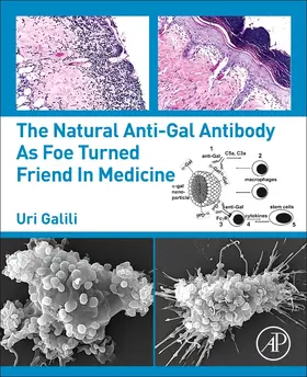 Galili |  The Natural Anti-Gal Antibody as Foe Turned Friend in Medicine | Buch |  Sack Fachmedien