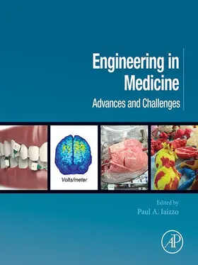 Iaizzo | Engineering in Medicine | E-Book | sack.de