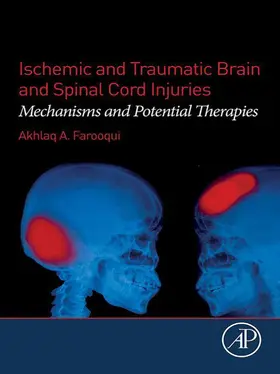 Farooqui |  Ischemic and Traumatic Brain and Spinal Cord Injuries | eBook | Sack Fachmedien
