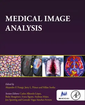 Frangi / Prince | Medical Image Analysis | Buch | 978-0-12-813657-7 | www.sack.de