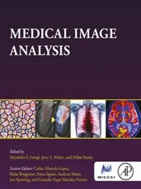 Frangi / Prince / Sonka |  Medical Image Analysis | eBook | Sack Fachmedien