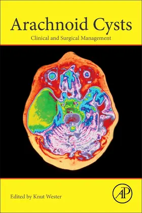 Wester |  Arachnoid Cysts | Buch |  Sack Fachmedien