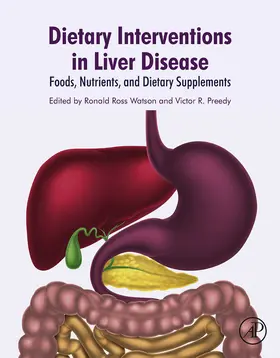 Watson | Dietary Interventions in Liver Disease | E-Book | www.sack.de