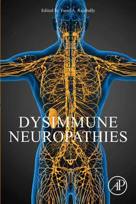 Rajabally | Dysimmune Neuropathies | E-Book | sack.de