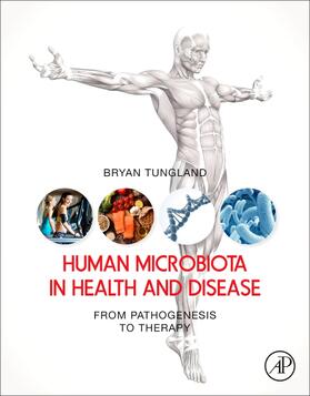 Tungland |  Human Microbiota in Health and Disease | Buch |  Sack Fachmedien