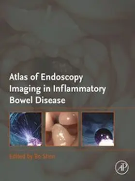Shen MD / Shen |  Atlas of Endoscopy Imaging in Inflammatory Bowel Disease | eBook | Sack Fachmedien