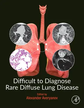 Averyanov |  Difficult to Diagnose Rare Diffuse Lung Disease | Buch |  Sack Fachmedien