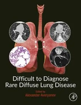 Difficult to Diagnose Rare Diffuse Lung Disease | E-Book | www.sack.de