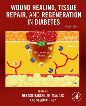 Bagchi / Das / Roy |  Wound Healing, Tissue Repair, and Regeneration in Diabetes | eBook | Sack Fachmedien