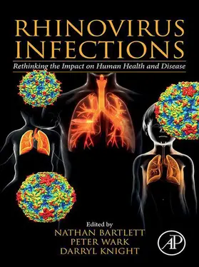 Bartlett / Wark / Knight |  Rhinovirus Infections | eBook | Sack Fachmedien