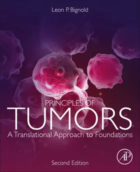 Bignold |  Principles of Tumors | Buch |  Sack Fachmedien