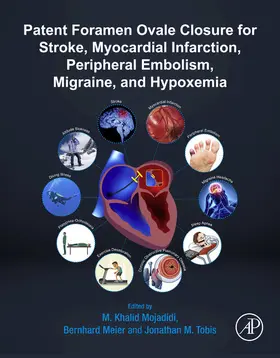 Mojadidi MD / Meier MD / Meier | Patent Foramen Ovale Closure for Stroke, Myocardial Infarction, Peripheral Embolism, Migraine, and Hypoxemia | E-Book | www.sack.de
