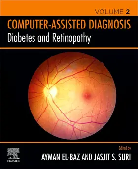 S. El-Baz / Suri | Diabetes and Retinopathy | Buch | 978-0-12-817438-8 | www.sack.de
