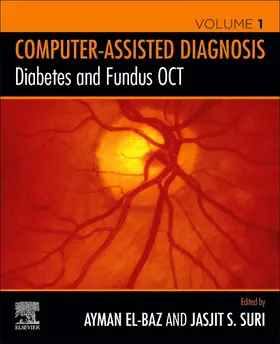 S. El-Baz / Suri | Diabetes and Fundus OCT | Buch | 978-0-12-817440-1 | sack.de