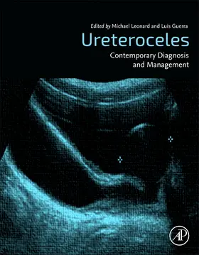 Leonard / Guerra |  Ureterocoeles: Contemporary Diagnosis and Management | Buch |  Sack Fachmedien