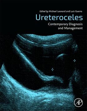 Leonard / Guerra | Ureterocoeles: Contemporary Diagnosis and Management | Buch | 978-0-12-817888-1 | sack.de