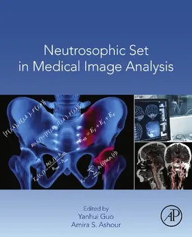 Guo / Ashour | Neutrosophic Set in Medical Image Analysis | E-Book | sack.de