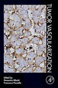 Ribatti / Pezzella |  Tumor Vascularization | Buch |  Sack Fachmedien