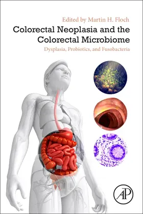 Colorectal Neoplasia and the Colorectal Microbiome | Buch | 978-0-12-819672-4 | sack.de