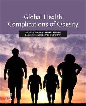 Moini / Ahangari / Miller | Global Health Complications of Obesity | Buch | 978-0-12-819751-6 | sack.de