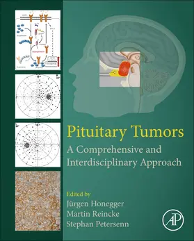 Honegger / Reincke / Petersenn | Pituitary Tumors | Buch | 978-0-12-819949-7 | www.sack.de