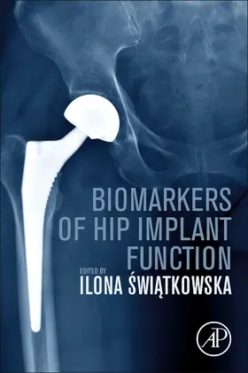 Swiatkowska |  Biomarkers of Hip Implant Function | Buch |  Sack Fachmedien