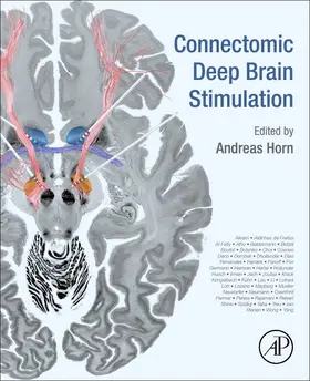 Horn | Connectomic Deep Brain Stimulation | Buch | 978-0-12-821861-7 | sack.de