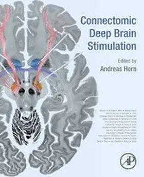 Horn | Connectomic Deep Brain Stimulation | E-Book | sack.de