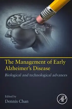 Chan | Early Detection of Alzheimer's Disease | E-Book | www.sack.de