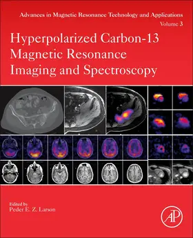 Larson | Hyperpolarized Carbon-13 Magnetic Resonance Imaging and Spectroscopy | Buch | 978-0-12-822269-0 | sack.de