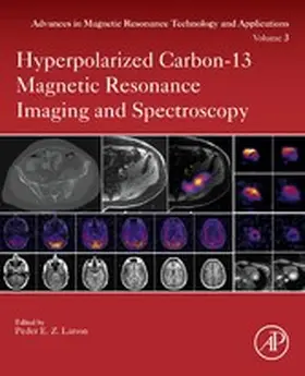 Larson |  Hyperpolarized Carbon-13 Magnetic Resonance Imaging and Spectroscopy | eBook | Sack Fachmedien