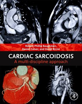 Culver / Baughman / Birnie | Cardiac Sarcoidosis | Buch | 978-0-12-822332-1 | sack.de