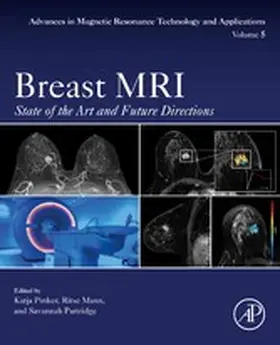 Pinker / Mann / Partridge |  Breast MRI | eBook | Sack Fachmedien